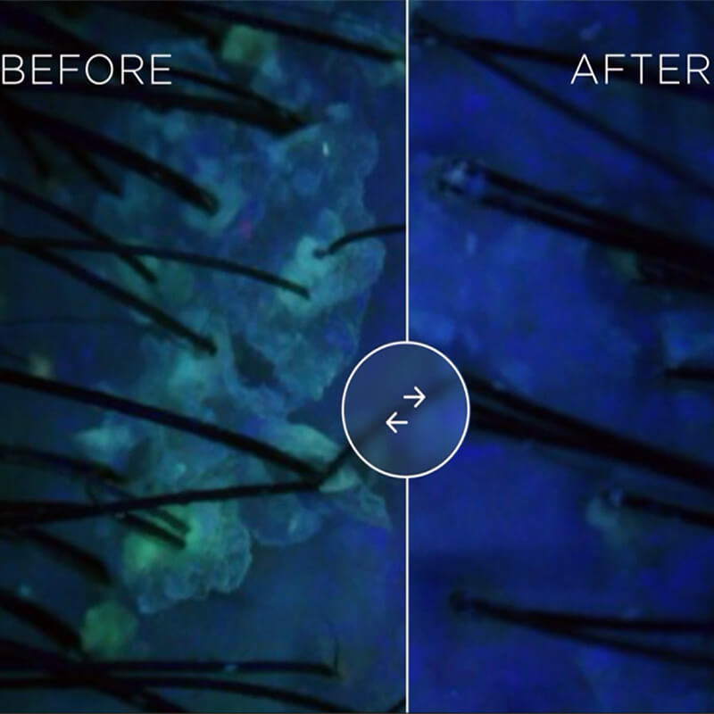 K-Scan: Kamera von Kérastase zur Haar- und Kopfhautanaylse mit KI